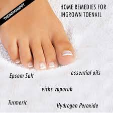 top home remes for ingrown toenail