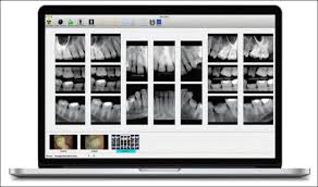 We start with various photos and make basic corrections, then we kick our right brain into gear and turn them into wonderful pieces of art! Digital Imaging Basics Digital Imaging In Dentistry Intraoral Extraoral And 3d Technology Continuing Education Course Dentalcare Com
