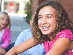 In order to help move the teeth in the intended direction, rubber bands can be worn from the front top teeth to the front bottom teeth to help close that open bite. Braces With Rubber Bands Purpose And How Long They Stay On