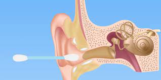 Forget Q Tips Here S How You Should Be Cleaning Your Ears Cleaning Your Ears Ear Wax Ear Cleaning