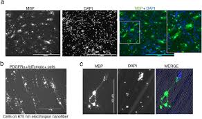 Single-Cell Transcriptomic Analysis Reveals Molecular Diversity of Human  Oligodendrocyte Progenitor Cells
