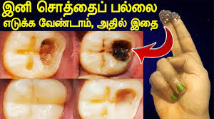 The method involves swishing a tablespoon of oil (either coconut oil or sesame oil) around inside the mouth for a few minutes before spitting it out. Download Teeth Tamil Mp4 Mp3 3gp Naijagreenmovies Fzmovies Netnaija