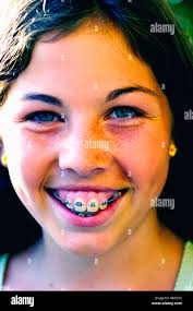 Vertical braces hi-res stock photography and images