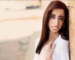 The following list, on the other hand, reveals the nationalities with the highest failure rates, i.e., the ugliest nationalities in the world. Labelled The World S Ugliest Woman Lizzie Velasquez Knows God Sees Her True Beauty Beauty Lizzie Velasquez Skinny Women