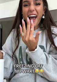 Natuurlijke remedies voor eczeem: Sheabutter & Frambozenzalf