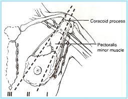 Its origin is at the lateral margin of the first rib, before which it is called the subclavian artery. A Practical Approach To Imaging The Axilla Insights Into Imaging Full Text