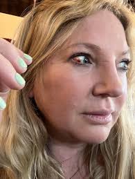 Golden Sunrise! I'm thrilled to share a miraculous experience! I was  diagnosed with extremely high eye pressure (46 mm hg in the left eye, 43 mm  hg in the right eye -