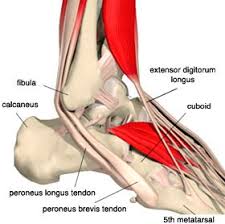 Moreover, tibialis anterior tendonitis is the most typical of its kind. Martial Arts Injuries Foot Pain Tendonitis Of The Dorsum Of The Foot