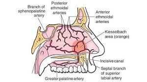 Image result for Epistaxis
