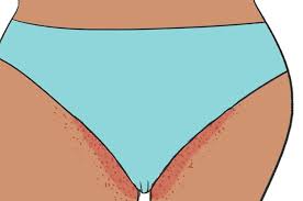 They are usually small (usually less than 2 inches with pubic hair—and other body hair—the entire process takes about 30 to 44 days, dr. 23 Things You Should Know About Pubic Hair