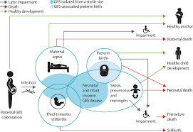 Image result for Group B Streptococcus Prophylaxis