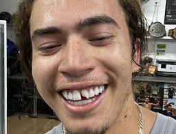 Tem gente que olha minha identidade e fala assim: Whindersson Nunes Quebra Dente Apos Treinar Sem Protecao Vacilei Jovem Pan