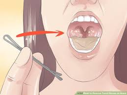 Pin On Homemade Remedies