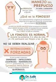 Dr Luis Davila Manejo Del Prepucio En Bebes Ninos Y Facebook