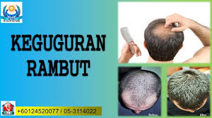 Home » model rambut » page 4. Rawatan Rambut Gugur Terbaik Di Ipoh Ipoh Hair