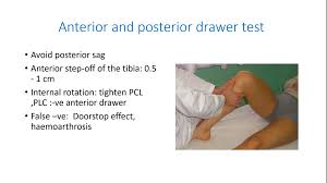 The anterior drawer test has to be performed exactly. Orthopaedic Cases Discussion Facebook