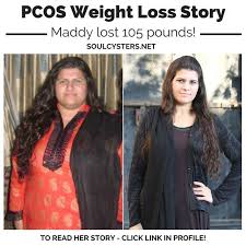 Pin On Pcos Weight Loss Stories