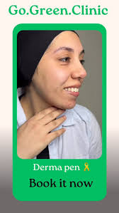 #dermapen , #gogreenclinic , #glowyskin , #نضاره_البشره ,  #ديرمابن_علاج_مسامات_علاج_تصبغات_شدالبشرة_نضارة_تفتيتح , #skintightening