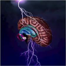 Geschwind Syndrome Dr Maad Medical Encyclopedia Facebook