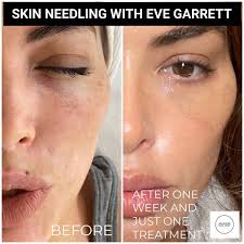 Advanced Face And Body (@advancedfaceandbody) • Instagram photos and videos