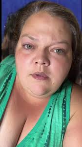 Tammy Lous Teeth Before