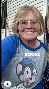 1st picture was July 2023. 311 lbs Sleeve surgery August 1, 2023 2nd  picture is today November 2024. 146 lbs