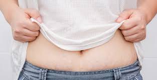 كيفية علاج تشققات البطن stretch marks prevent stretch marks skin tightening mask