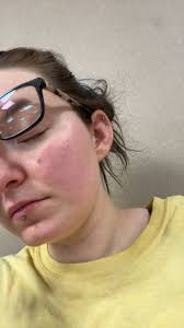 Authenticity of Happiness and High Blood Pressure