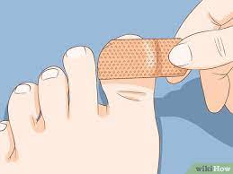 Apr 12, 2021 · how long will it take for my toenail to grow back? How To Help A Toenail Grow Back Quickly 15 Steps With Pictures