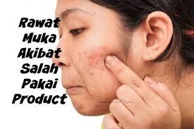 Tiada siapa yang inginkan kulit muka yang buruk dan rosak. Rawat Muka Akibat Salah Pakai Product Bebelsihat Com