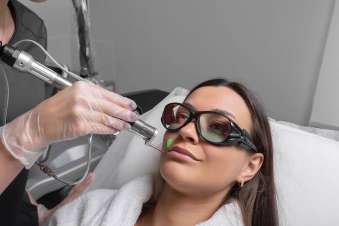 Co2 Laser in Manchester Recovery Timeline And Aftercare