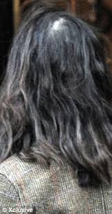 These hair loss causes can happen at any age, and will usually continue until the external factors have been addressed. Female Hair Loss When Thea Jourdan Hit 40 Her Glorious Chestnut Mane Began To Fall Out Daily Mail Online