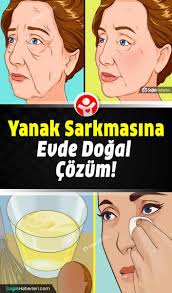 Yanak Sarkmasi Nedir Neden Olur Dogal Cozumler Neler Cilt Bakimi 2020 Cilt Bakimi Dogal Cilt Bakimi Tuyolari