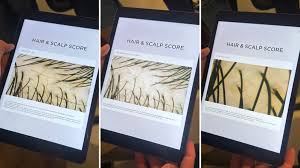 Image result for HAIR Score