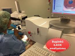 Gozunde Aberrasyon Denen Kusurlari Olanlar Ozellikle Ilasik Yontemini Tercih Etmeli Aberrasyonlar Ilasik Oncesi Yapilan Tetkiklerle Tespit Bilgi Serum Ikiz