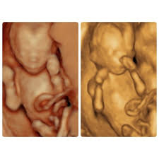 When i was 31 weeks i went back for our first 3d/4d ultrasound and it was even more special being able to see my son's face for the very first time. 22 Week 3d Ultrasound Pictures A Date With Baby