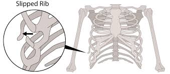 The human rib cage is made up of 12 paired rib bones; Rib Injuries In Swimmers A Pain In The Chest You Really Should Avoid