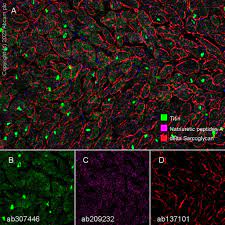 Recombinant Anti-Natriuretic peptides A antibody [EPR20247] - BSA and Azide  free (ab225873)