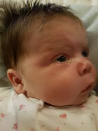 You will probably find this to be an extra demanding week. 5 Week Old Baby Maybe Conjunctivitis Please Take A Look And See What You Think Babycentre