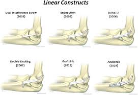 It features pucks signed by hockey legends mark messier, mario lemieux, martin brodeur, bobby orr, and sidney crosby. The History And Evolution Of Elbow Medial Ulnar Collateral Ligament Reconstruction From Tommy John To 2020 Abstract Europe Pmc
