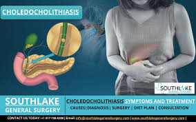Image result for Choledocholithiasis