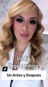 Casandra Castro Antes Y Después