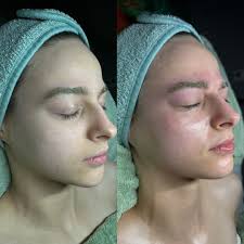 Jenna Jarrett (@skinwithjenesthetics) • Instagram photos and videos