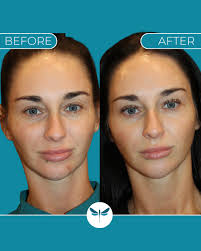 We saved the best for last, Dr. Jennifer Upton, FNP-C. Jen is not only the  owner, but our amazing leader and provider. She preforms every aesthetic  service we offer, plus advanced laser