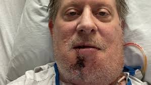 Fundraiser for Scott Gorton by Bryan Parman : Scotty's second chance at  life!