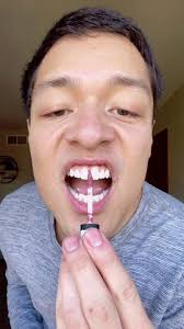 Blizzard vs beach day