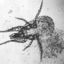 Examples include lichens (composed of an alga and a fungus) and the relationship humans have with the intestinal commensalistic. Pdf Parasites And Pathogens Of Mites
