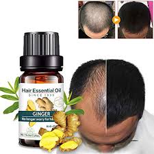 Conventional treatment for thinning hair. Natural Ginger Hair Growth Oil Plant Essence Liquid Fast Hair Growth Thickening Natural Hair Loss Thinning Hair Treatment Products Chinese Herbal Formula 1 Pc Buy Online In Botswana At Botswana Desertcart Com Productid