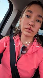 Philtrum piercing concerns