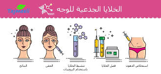 يتم استخدام الخلايا الجذعية من النخاع العظمي بشكل متزايد ويتم استبدالها بالخلايا الجذعية الطرفية. Ø§Ù„Ø¹Ù„Ø§Ø¬ Ø¨Ø§Ù„Ø®Ù„Ø§ÙŠØ§ Ø§Ù„Ø¬Ø°Ø¹ÙŠØ©